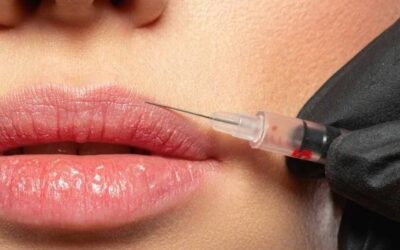 FILLERS O MATERIALES DE RELLENO